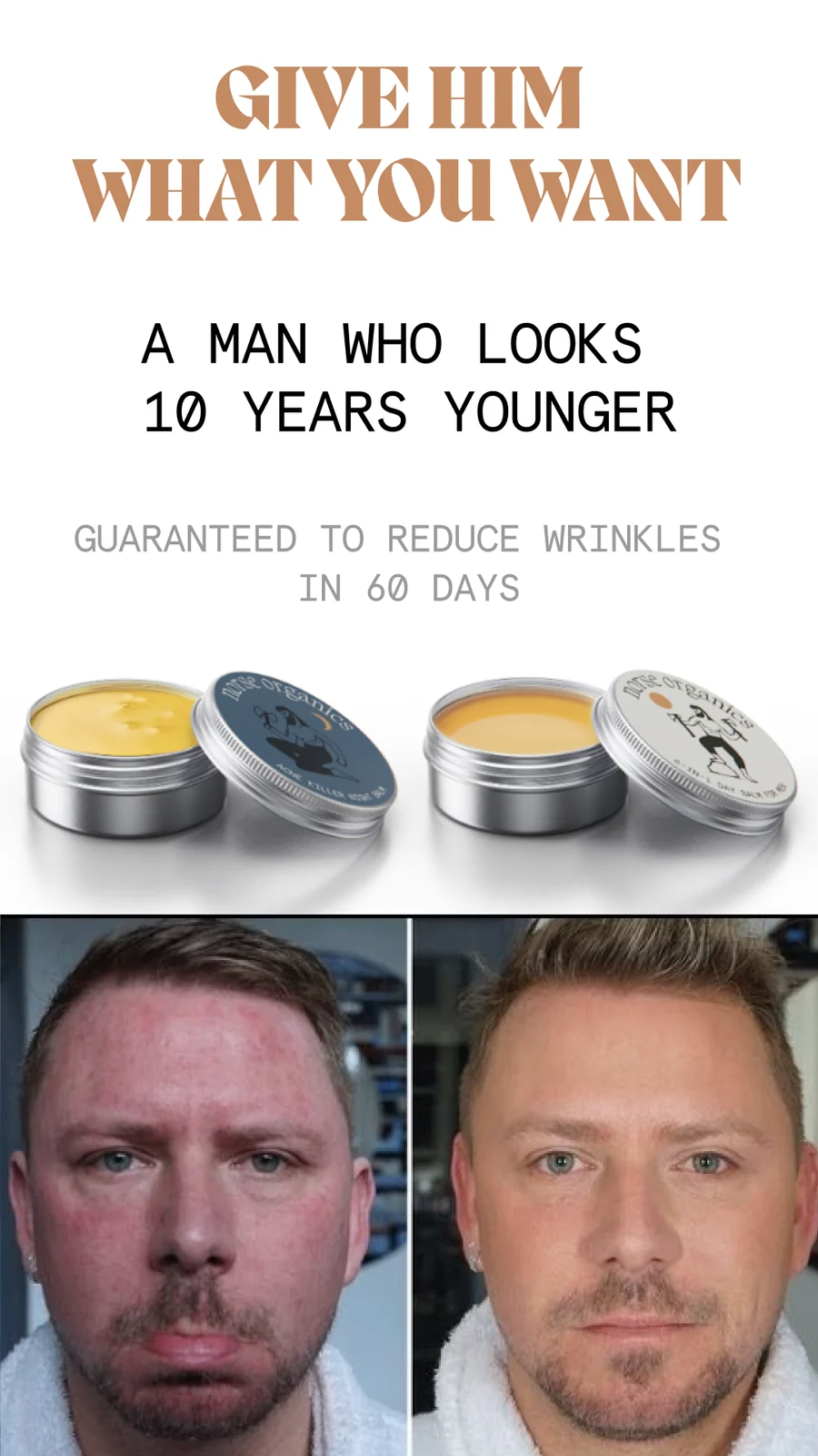 Story ad with a before-and-after comparison and a 60-day wrinkle-reduction guarantee